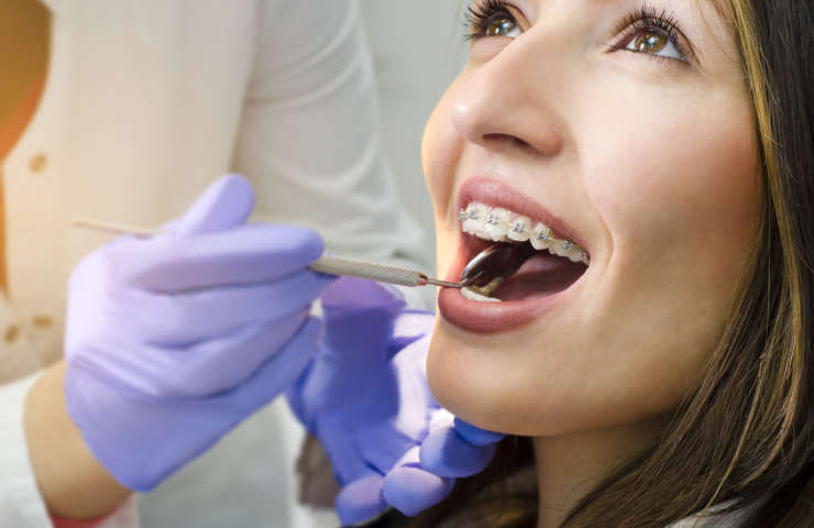 Braces vs Invisible Braces- What is the Difference?