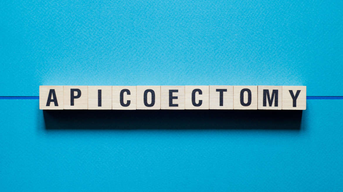 What is Apicoectomy?