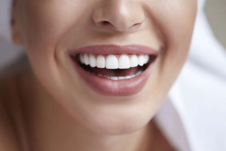 teeth whitening massachusetts