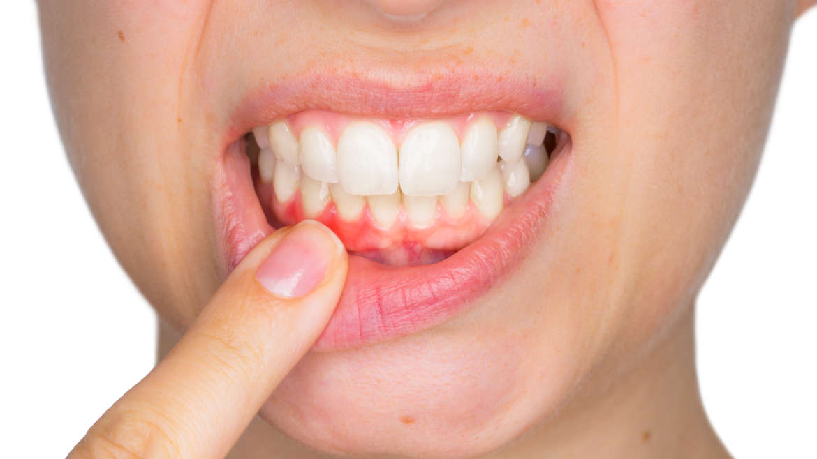 4 Signs You Need a Massachusetts Gum Specialist