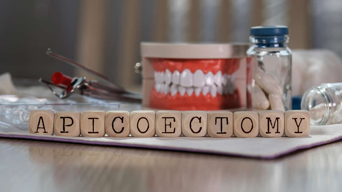 When Is It Time For An Apicoectomy In Massachusetts?