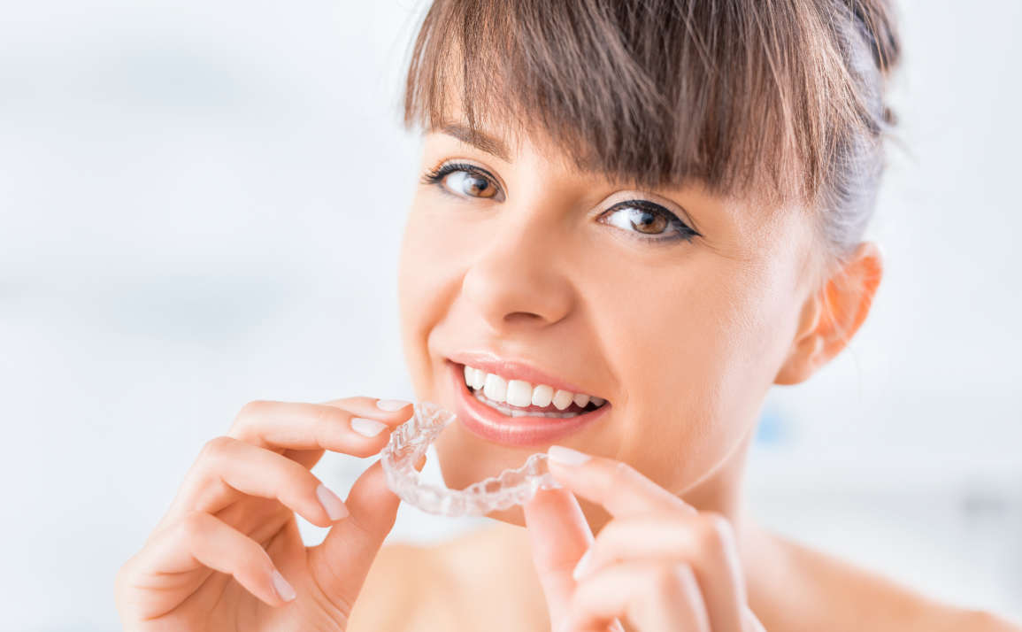 4 Benefits of Getting Invisalign