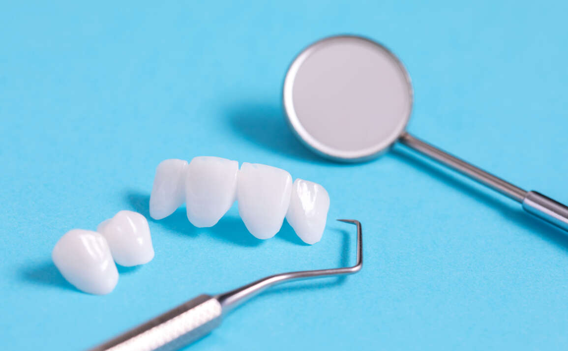 Lumineer Massachusetts: 7 Benefits of Lumineers