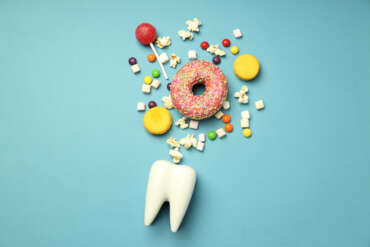 Tooth Decay and Sugar: Understanding the Connection