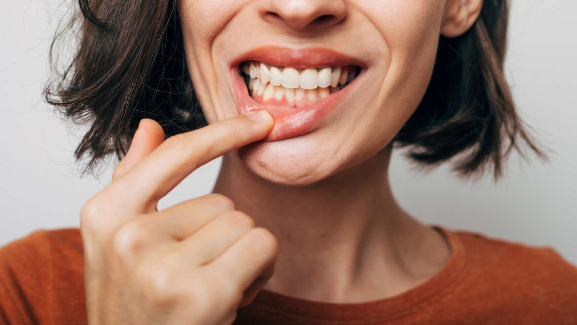 Early Signs of Gum Disease You Should Never Ignore