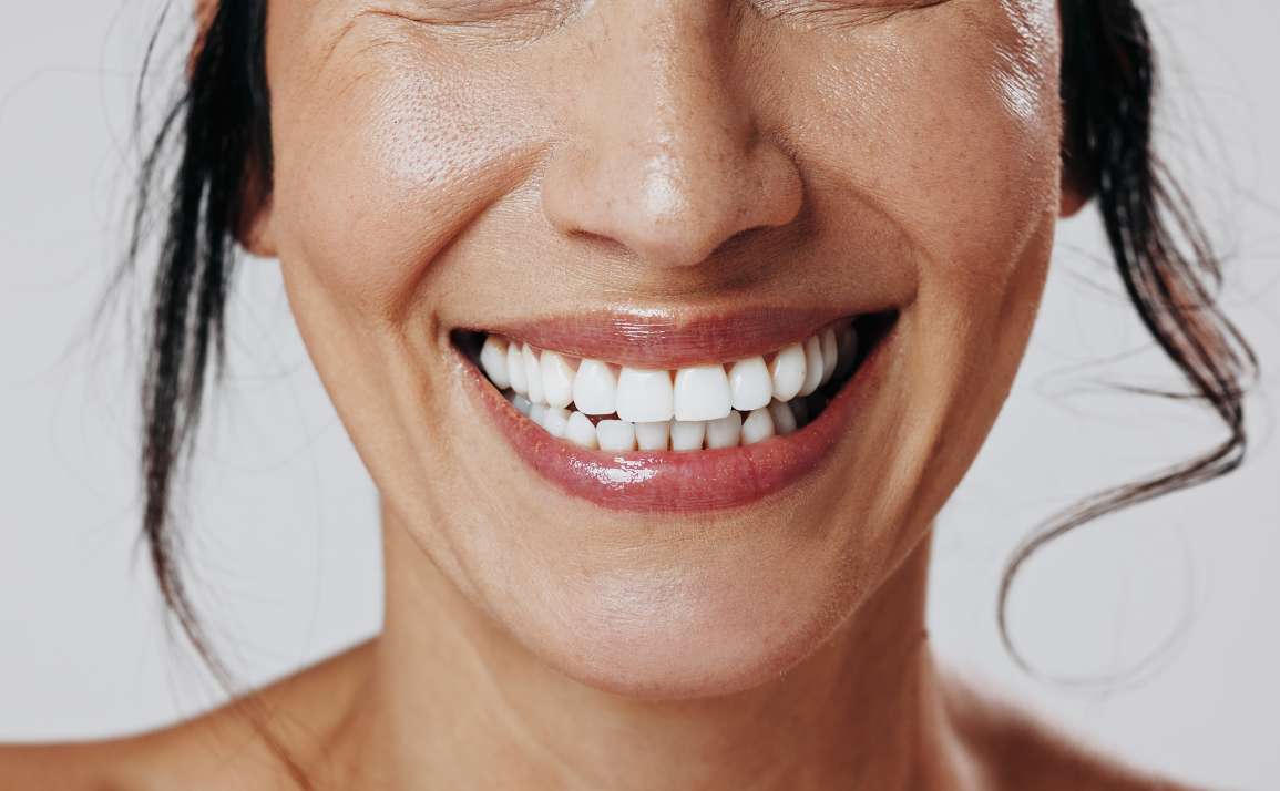 What to Know Before Choosing Teeth Whitening