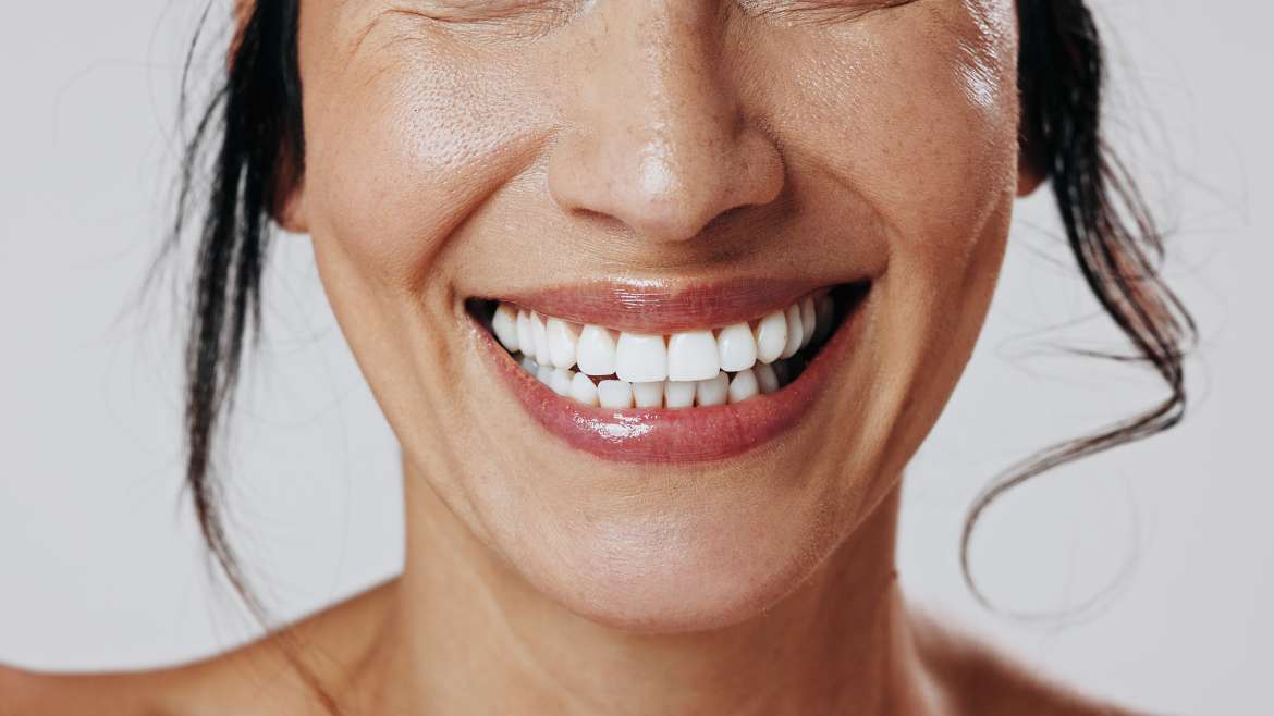 What to Know Before Choosing Teeth Whitening