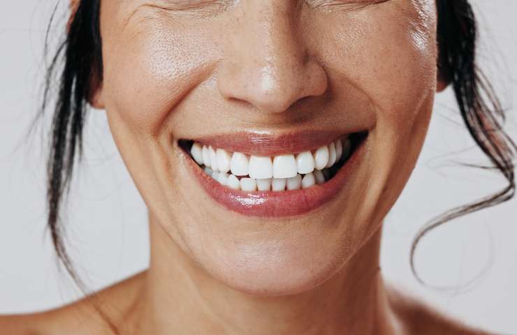 What to Know Before Choosing Teeth Whitening